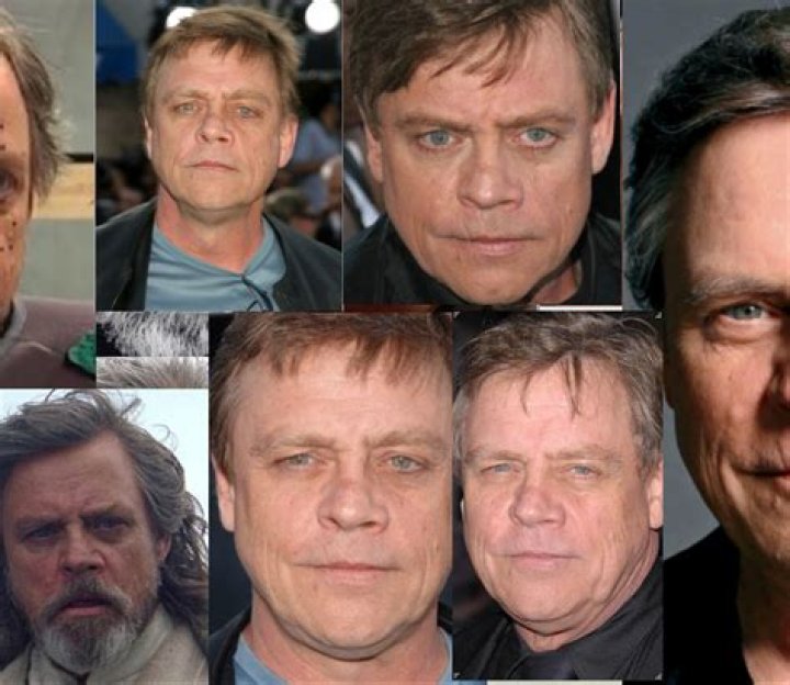 Mark Hamill Face Surgery: Accident And Health 2023